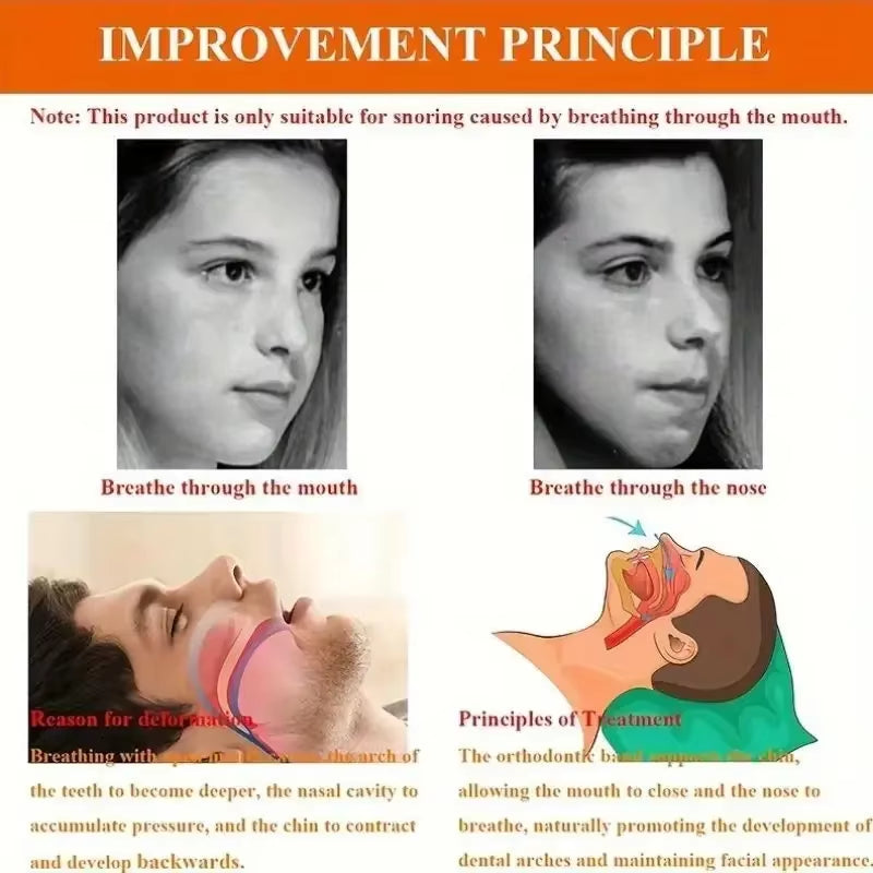 Anti-Snoring Band Open Mouth Breathing Corrective Anti-Snoring Chin Rest Sleep Open Mouth Rest